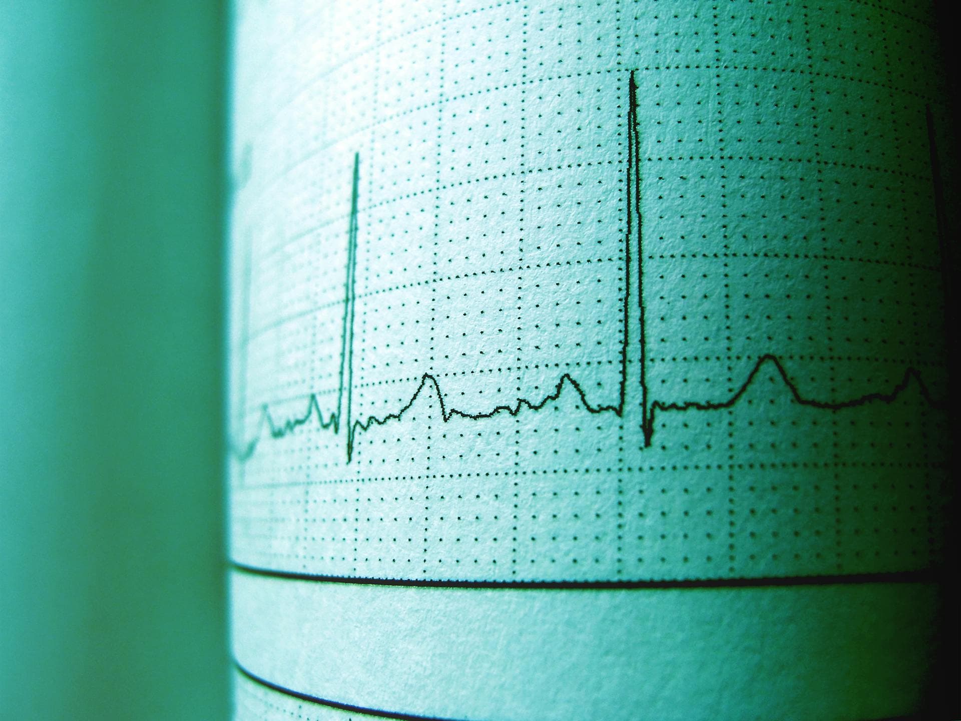 Cardiac Assessment & Intervention