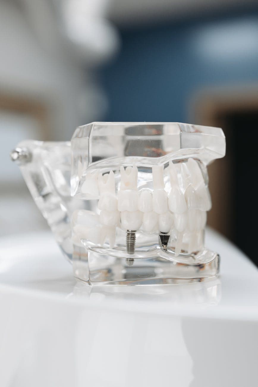 Dental implant model at Istanbul clinic
